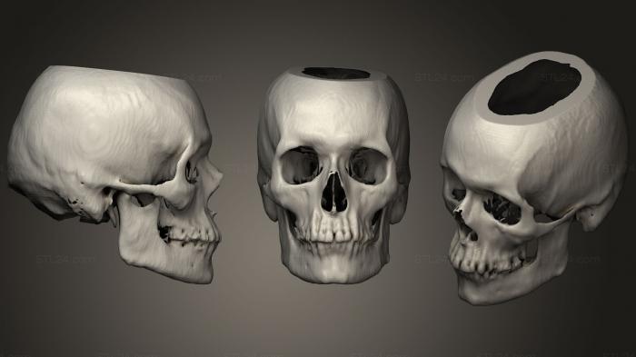 Анатомия скелеты и черепа (Череп Мужской 72лет, ANTM_1296) 3D модель для ЧПУ станка